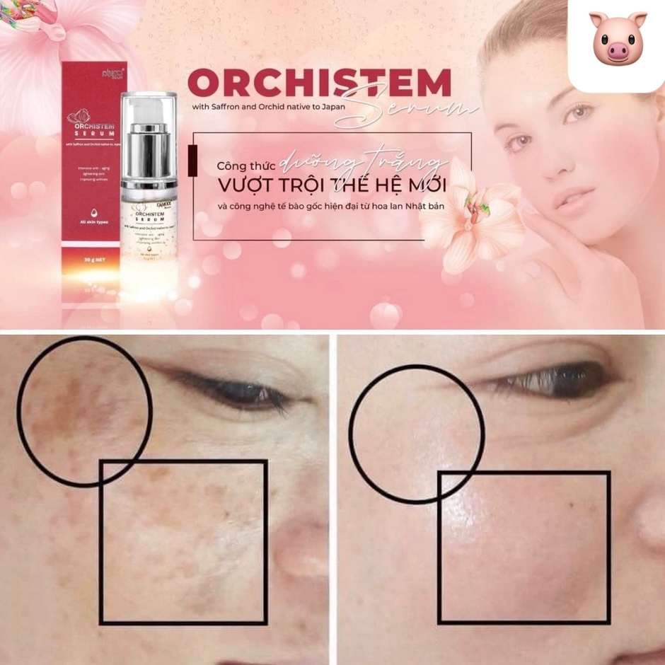 Tinh chất tế bào gốc mờ nám, trắng da, chống thâm sạm Orchistem Serum 20g