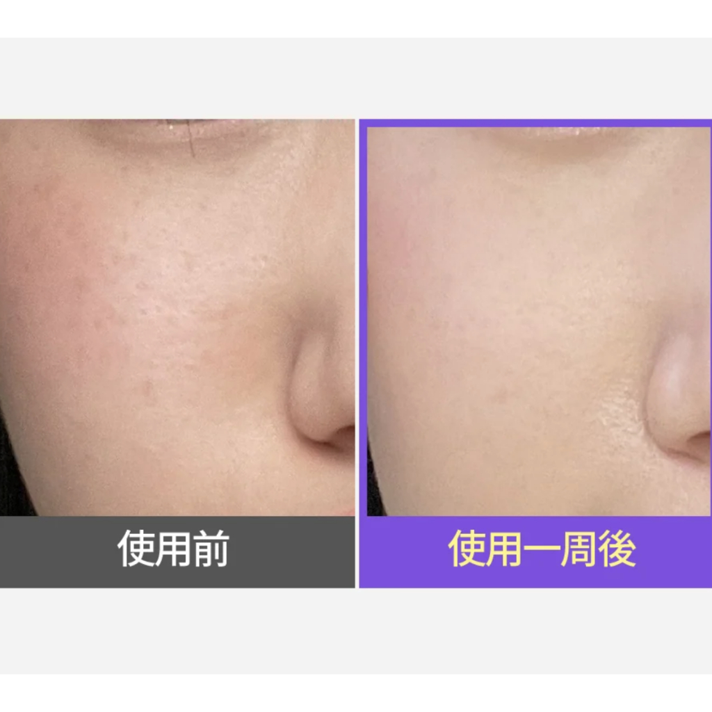 SERUM giảm thâm sạm mụn tàn nhang nho tím SUNGBOON EDITOR MEORU PODO VITA C DARK SPOT AMPOULE 30ml