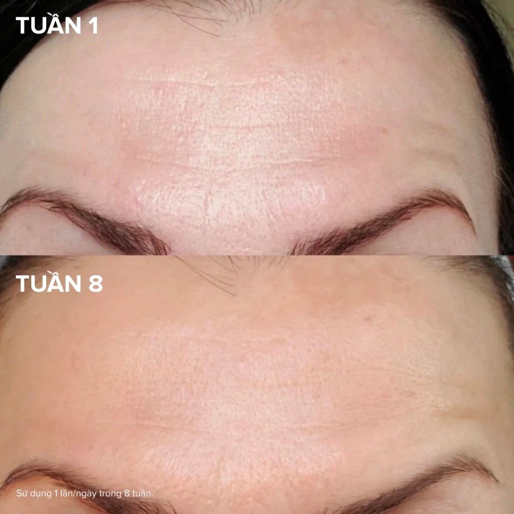 Tinh Chất Làm Căng Mịn & Săn Chắc Làn Da Pro-Collagen Multi-Peptide Booster 30ml