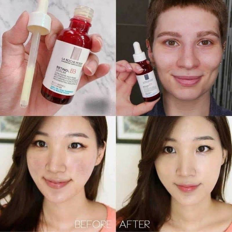 (2/2024) Tinh chất La Rochee-Posay Retinol B3 Serum 30ml giúp giảm thâm nám, nếp nhăn, đều màu da, chống lão hoá