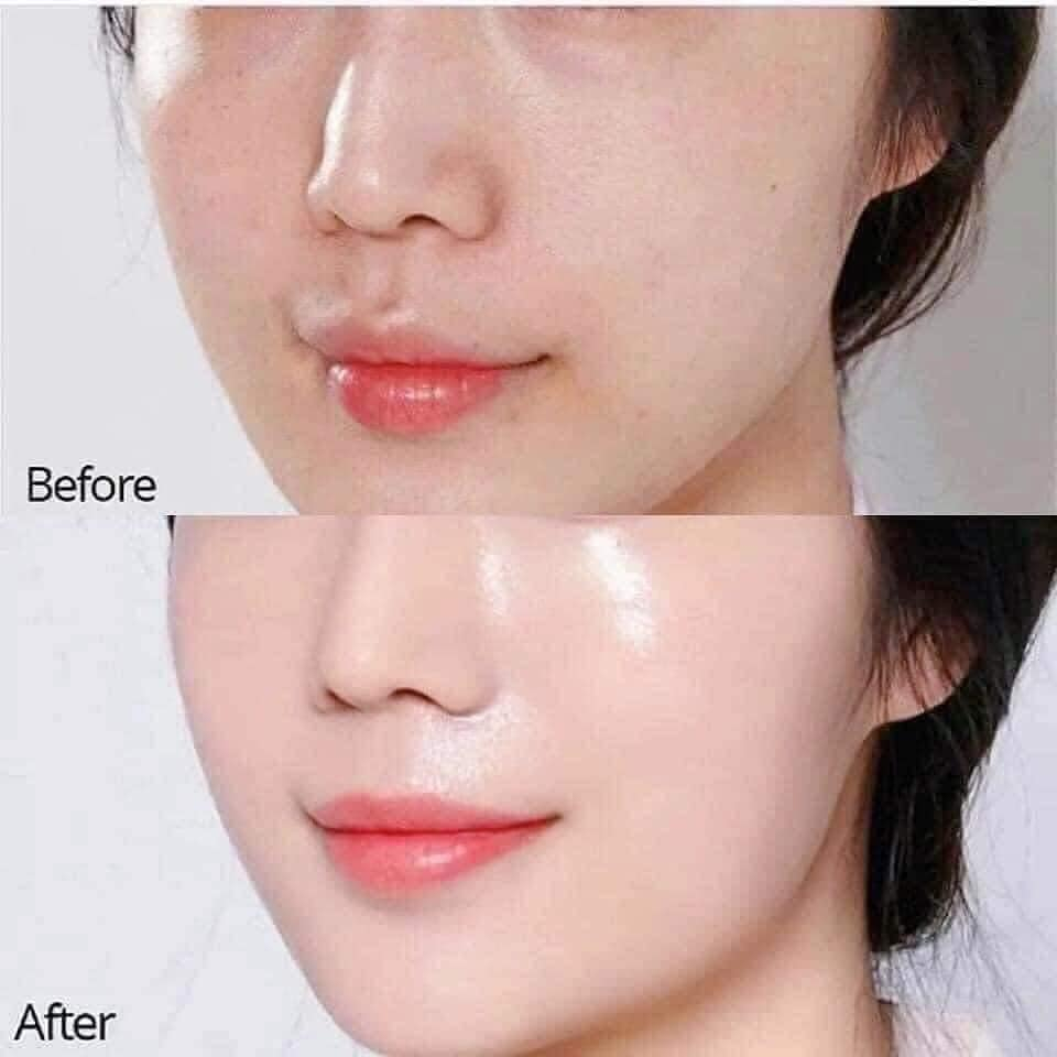 Tinh Chất Tái Tạo Da Red Peel Tingle/White Serum - 11ml