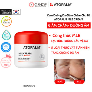 (Hỏa Tốc HCM) Kem Dưỡng Da Giảm Chàm Cho Bé ATOPALM MLE CREAM giúp dưỡng ẩm