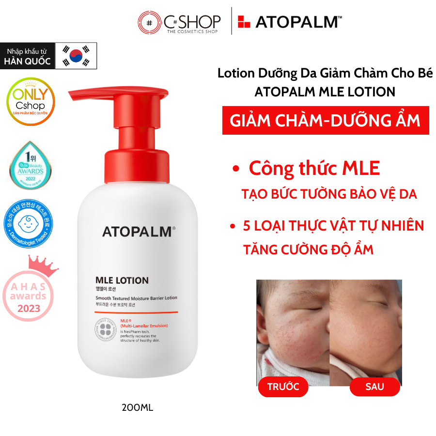 ( Hỏa Tốc HCM) Sữa Dưỡng Thể An Toàn Cho Bé ATOPALM MLE LOTION Dưỡng Ẩm Làm Dịu Da 200ml