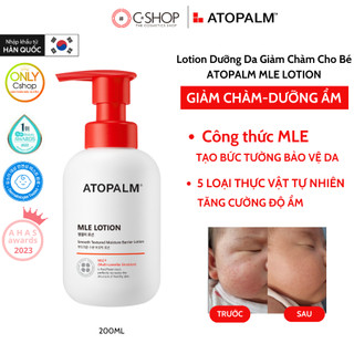 Sữa dưỡng thể an toàn cho bé atopalm mle lotion dưỡng ẩm làm dịu da 200ml