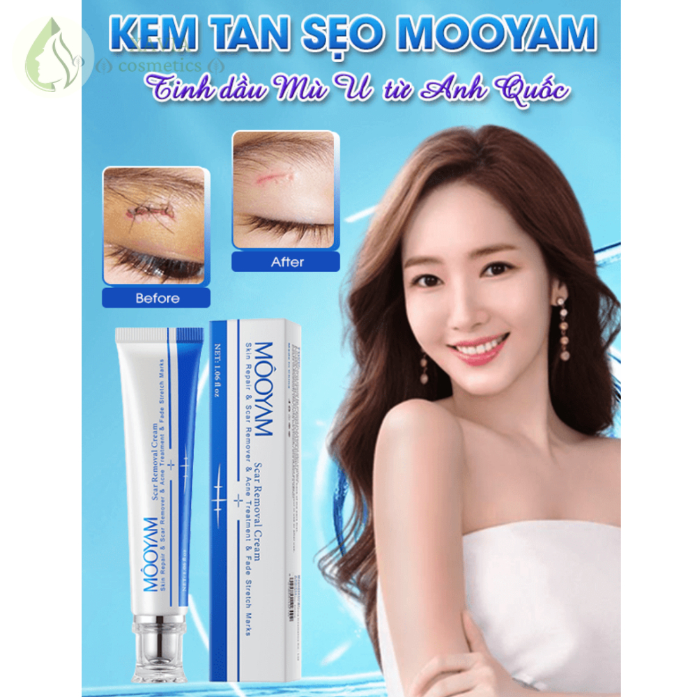 Kem mờ sẹo tinh dầu mù u từ Anh Quốc MOOYAM, Hỗ trợ mờ sẹo cũ, Đầy sẹo lõm, Làm mờ sẹo thâm - XAVIA COSMETICS