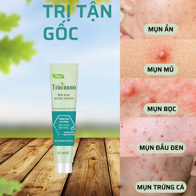 Serum Chấm Mụn Truenano Đánh Bay Các Loại Mụn, Mờ Sẹo, Thâm - Tuýp 15ml