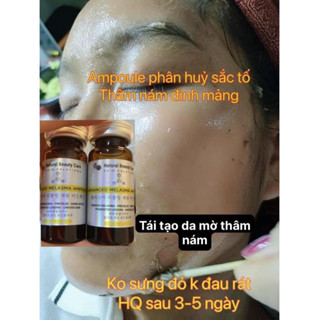 PEEL PHÂN HUỶ NÁM [CHÍNH HÃNG] Tinh chất phá sắc tố nám, Tinh chất phi tàn nhang, đồi mồi, phân hủy nám