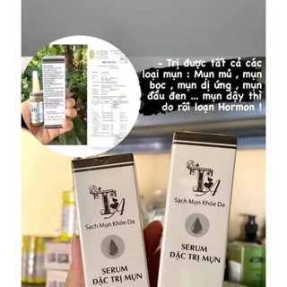 Serum mụn hiệu quả cao (SERUM MỤN TA dùng cho spa)