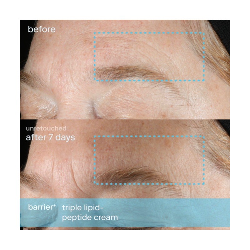 Kem dưỡng Skinfix mini 15ml $20