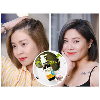 Xịt Kích Mọc Tóc Mostal Solution, Xịt mọc tóc kích thích tóc mọc nhanh dưỡng tóc chắc khoẻ