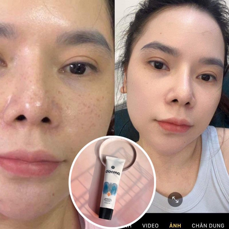 Kem dưỡng da, mờ nám và tàn nhang Derma Lightening Cream