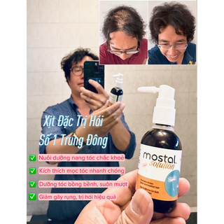 Xịt Kích Mọc Tóc Mostal Solution, Xịt mọc tóc kích thích tóc mọc nhanh dưỡng tóc chắc khoẻ
