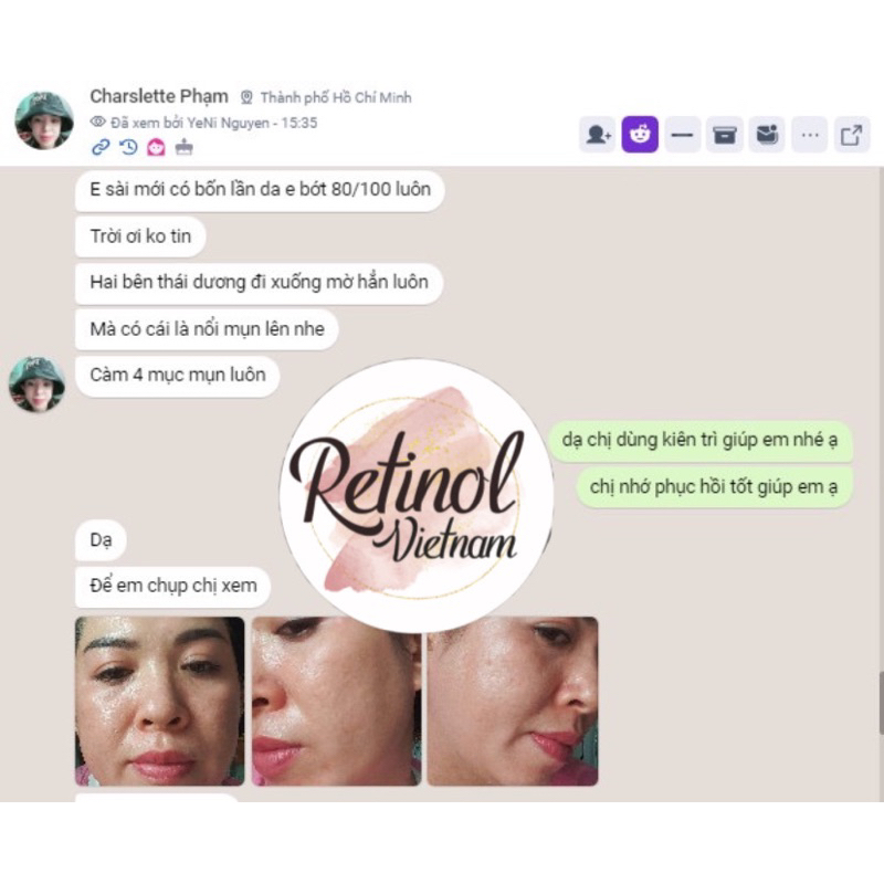 Kem dưỡng da, mờ nám và tàn nhang Derma Lightening Cream