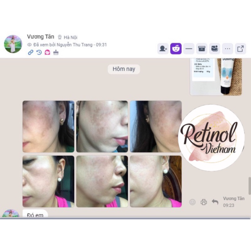 Kem dưỡng da, mờ nám và tàn nhang Derma Lightening Cream