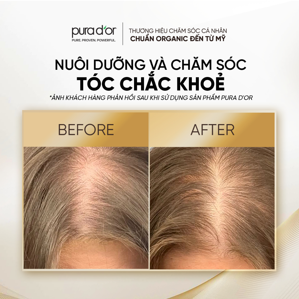 Combo Dầu Gội Dầu Xả Biotin Gold Label 236ML 473ML Organic Giảm Rụng Tóc PURA DOR