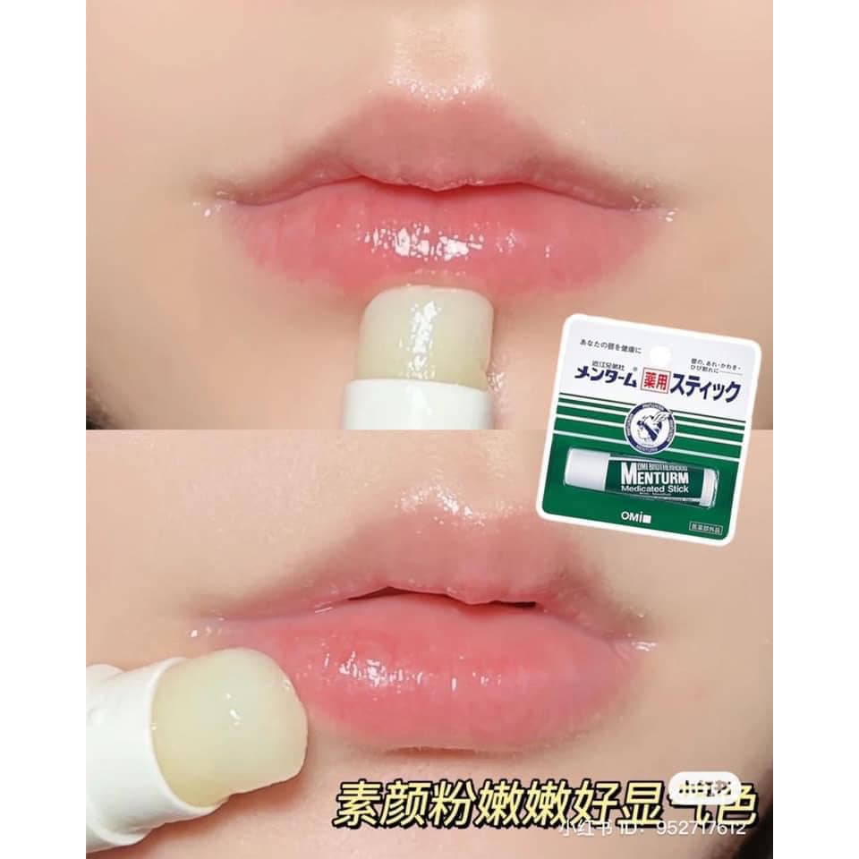 Son dưỡng môi giảm khô môi, nứt nẻ Omi Menturm Medicated Stick Nhật Bản - 4g