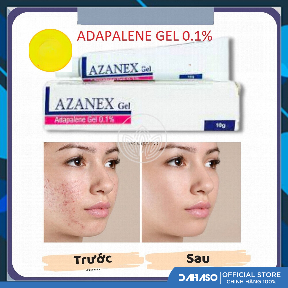 Azanex Gel bôi mụn ẩn 10g  - Dahaso Skin