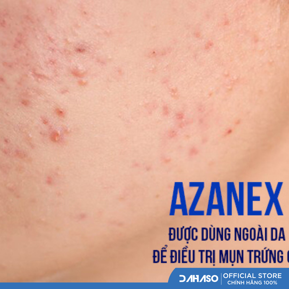 Azanex Gel bôi mụn ẩn 10g  - Dahaso Skin