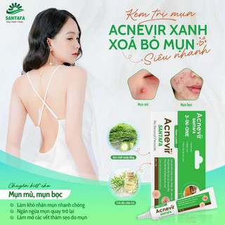✅kem giảm mụn mủ, mụn bọc, mụn đỏ và mụn trứng cá acnevir santafa - tuýp 10gr
