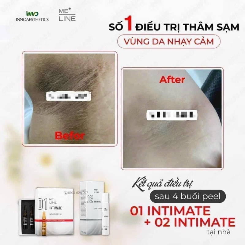 INTIMATE 01 MELINE,  tinh chất peel vùng kín  Innoaesthetics INNO