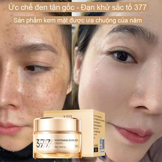 Kem xóa nám 30g Kem dưỡng trắng da và xóa tàn nhang Niacinamide làm mờ vết thâm nám tàn nhang xóa vết thâm