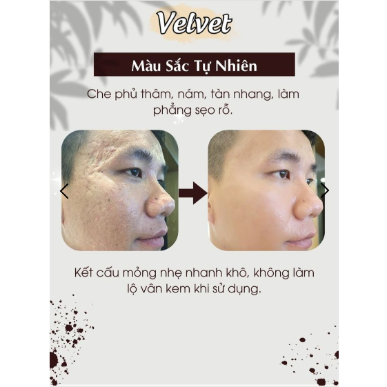 Kem che khuyết điểm VELVET - VELVET kem che khuyết điểm, che hình xăm, vết thâm nám, vết bầm, vết bớt hiệu quả