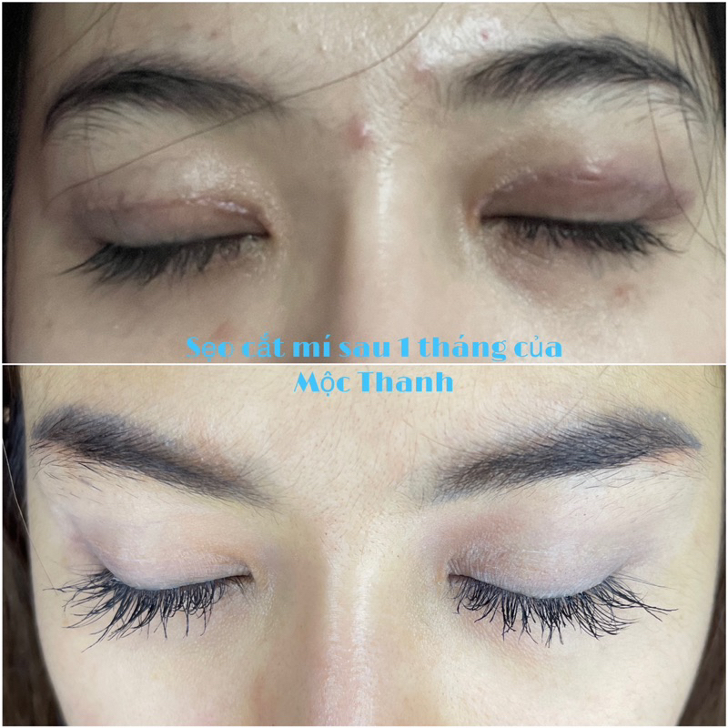 Kem Sẹo Dr Evamoon