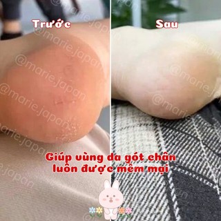 Kem Giảm Nứt Nẻ Gót Chân Glysolid Hautbalsam Đức 100ml