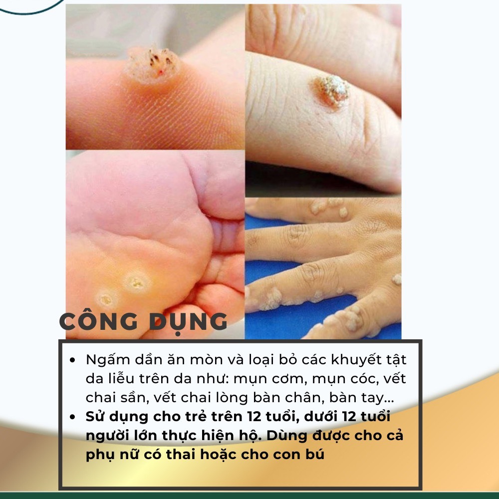 Loại bỏ mụn cóc, vết chai , mụn cơm , mắt cá chân hiệu quả