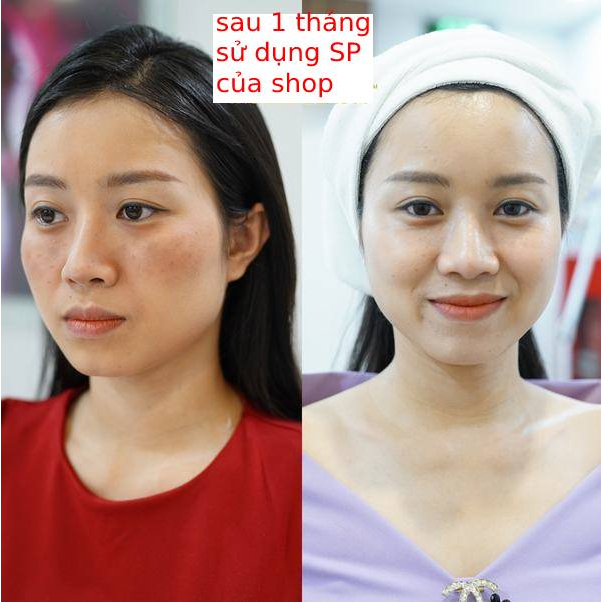 Viên Uống Glutathione 600 Dr Lacir Trắng Da Hạn Chế Lão Hoá Da Mờ Nám Giảm Nhăn