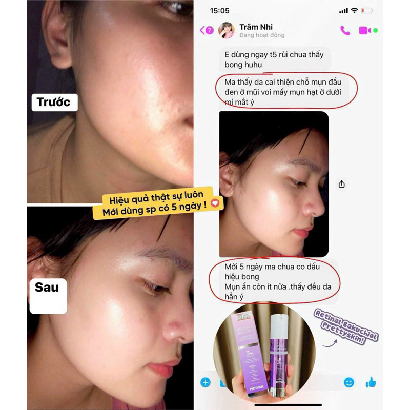 Retinal Pretty Skin, kem dưỡng Pretty Skin retinal bakuchiol A-mazing night cream tái tạo trẻ hóa, căng bóng đều màu da
