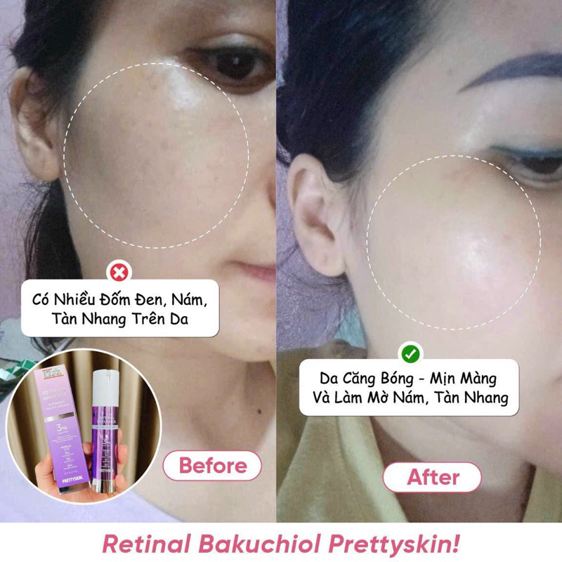 Retinal Pretty Skin, kem dưỡng Pretty Skin retinal bakuchiol A-mazing night cream tái tạo trẻ hóa, căng bóng đều màu da