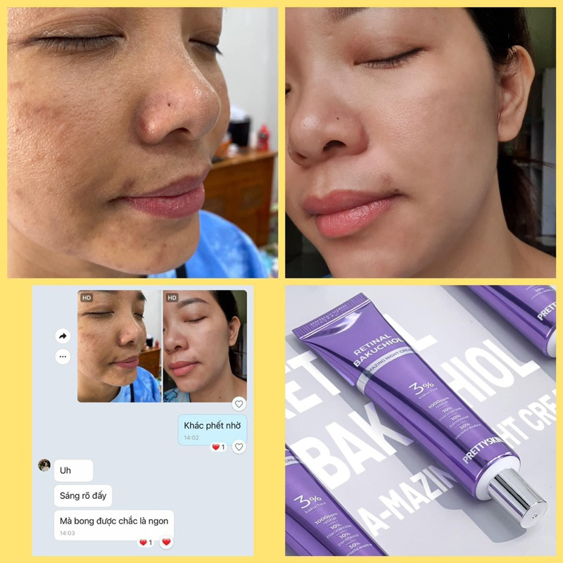 Retinal Pretty Skin, kem dưỡng Pretty Skin retinal bakuchiol A-mazing night cream tái tạo trẻ hóa, căng bóng đều màu da