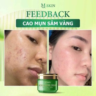 [Chính Hãng] Cao Mụn Sâm Vàng MQ Skin 20g