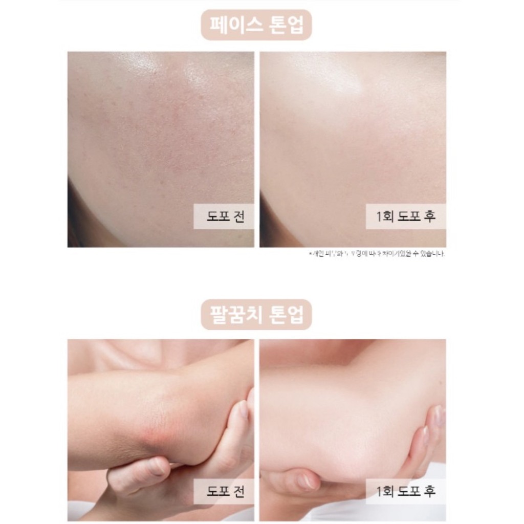 Kem dưỡng trắng da body khử thâm, chứa Vitamin C & Niacinamide Enough Secret W Whitening Cream 100g