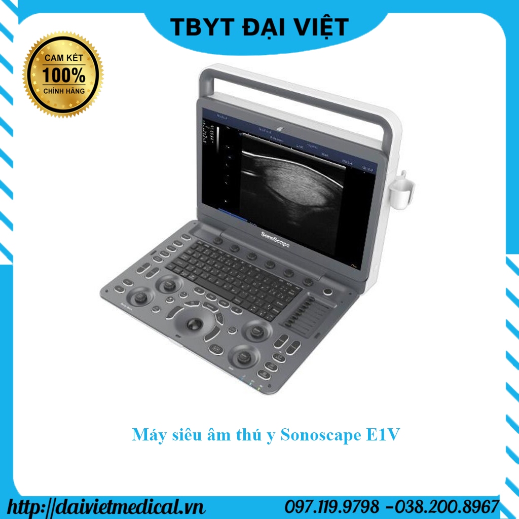 Máy siêu âm thú y Sonoscape E1V chính hãng bảo hành 12 tháng