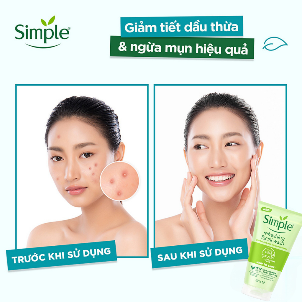 Sữa Rửa Mặt Simple, SRM Simple, Gel Rửa Mặt Cho Da Nhạy Cảm Dưỡng Ẩm Refreshing Chính Hãng Lành Tính Xanh Lá 150ml