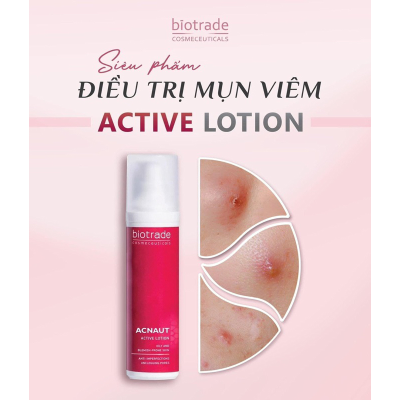 Dung Dịch Chấm Mụn Hoạt Tính Biotrade Acnaut Active Lotion 10ml