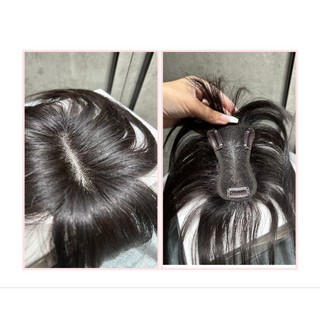 Tóc mái phủ hói siu lưới bằng tóc thặt