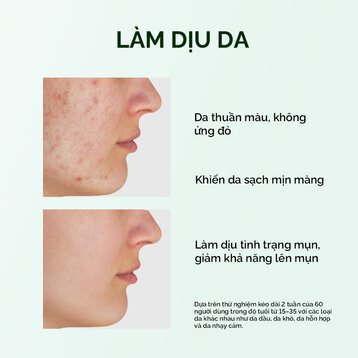 Thanh Lăn Mặt Nạ Đất Sét Skintific Ngải Cứu Giảm Mụn 40g Acne Clay Stick - Miss Xinh