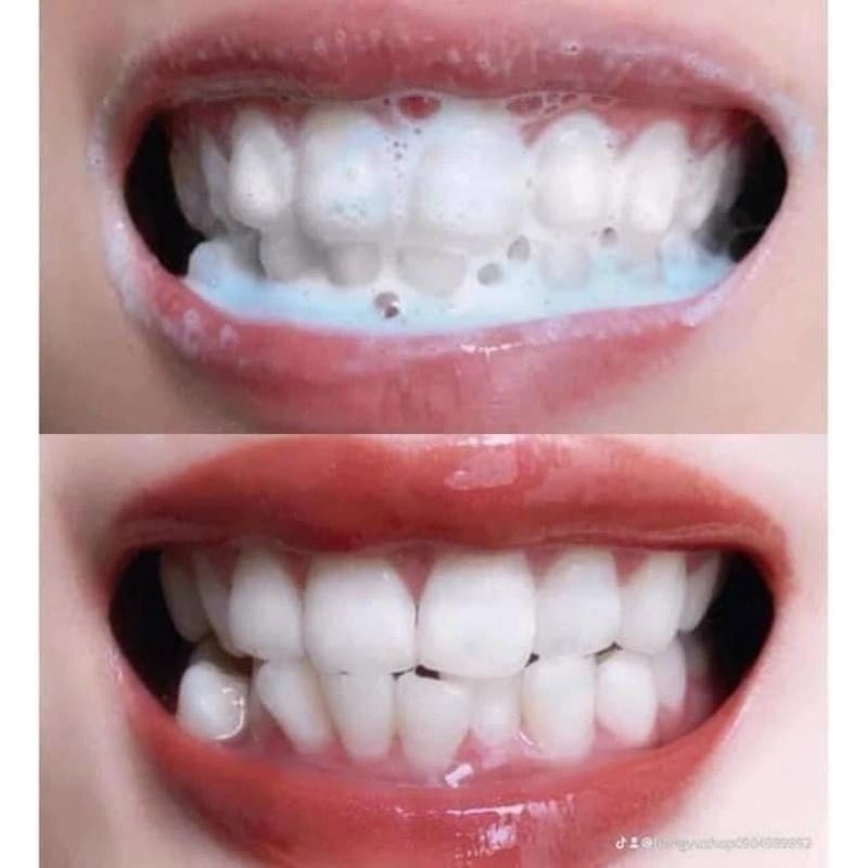 Bột Trắng Răng Dừa Green Herb Thái Lan, Giảm Mảng Bám, Sâu Răng, Hôi Miệng 25gr+10gr