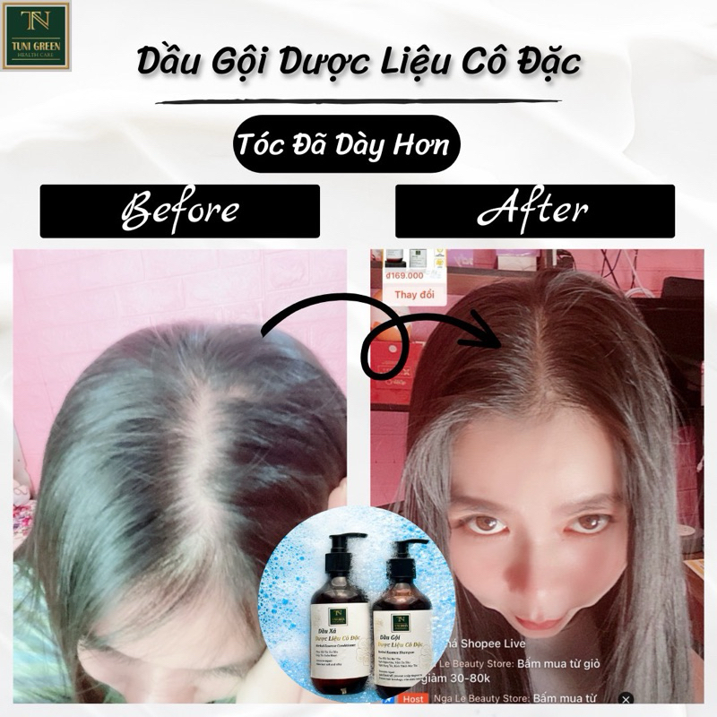 Combo Dầu Gội 250g, Dầu Xả 250g Tuni Green Phục Hồi Tóc Chuyên Sâu, Ngăn Ngừa Gàu, Nấm da đầu Dành Cho Mọi Loại Tóc