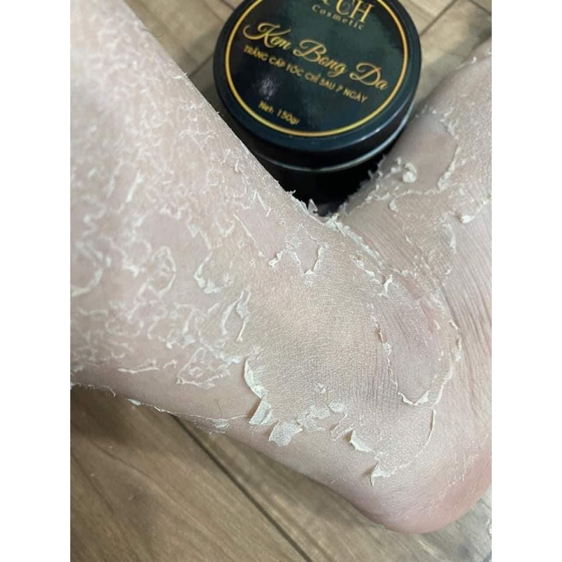 Kem Bong Da CH 150g- Kem Bong Da Body