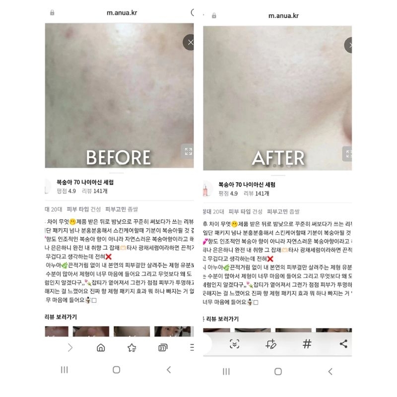 Serum dưỡng trắng Niacinamide 5% ANUA PEACH 70 NIACIN SERUM