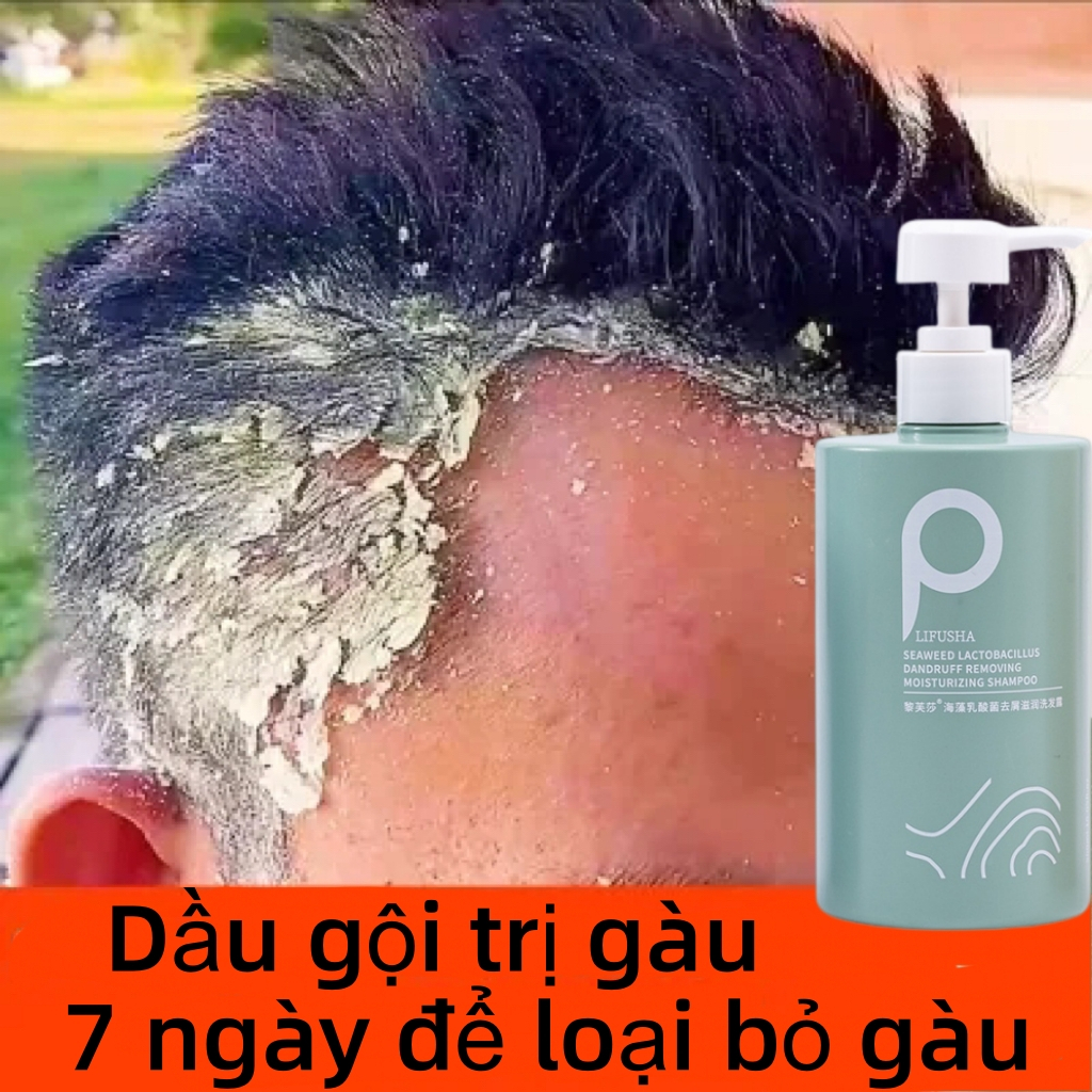 Dầu gội đầu Dầu gội muối biển dầu gội dầu gội giảm ngứa 500ml làm sạch sâu da đầu Làm mới kiểm soát dầu loại bỏ ngứa