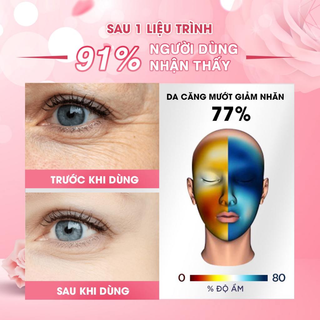 Serum Làm Trắng Cấp Ẩm & Giảm Nếp Nhăn Spotlite Dark Skin Spots Correction Hyaluronic Acid 2% 30ml