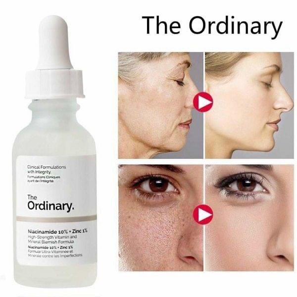 Serum ngừa mụn, sáng da, se khít Niacinamide 10% + Zinc 1% - The Ordinary 30ml