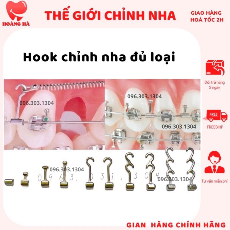 Hook chỉnh nha hỗ trợ niềng răng hiệu quả
