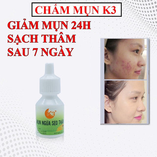 Chấm mụn. k3 giảm mụnn sau 24h sạch thâm sau 7 ngày