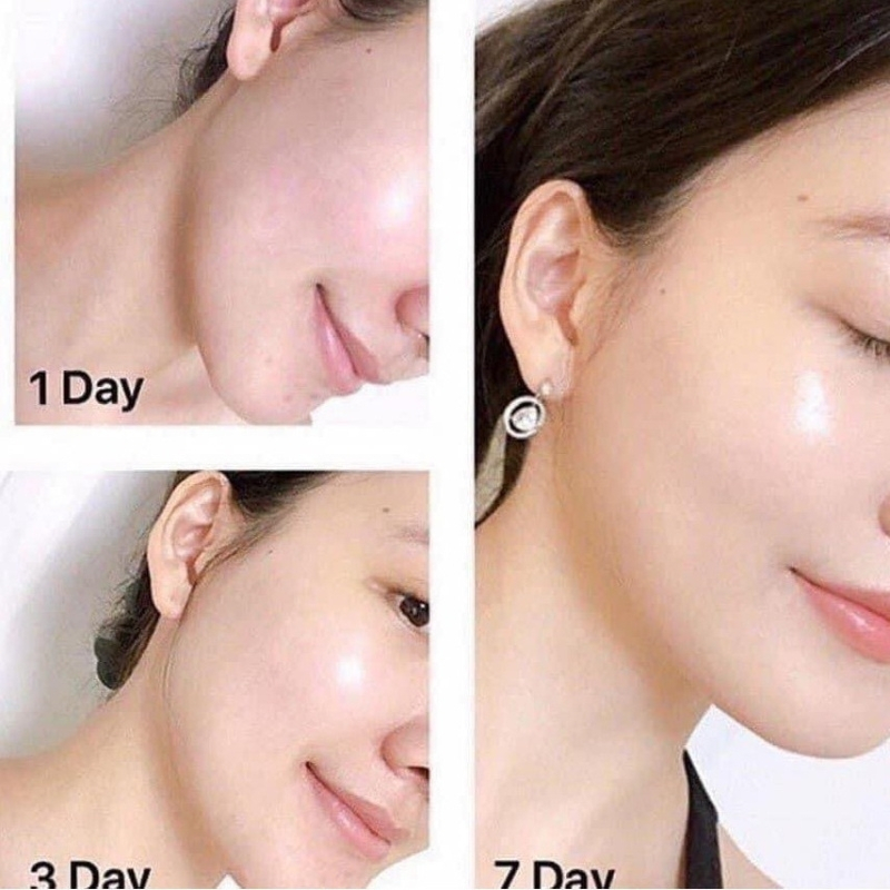 Kem Dưỡng Olay Total Effects 7 In 1 Ngày Và Đêm 50ml Chống Lão Hóa